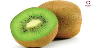 Kiwi Fruit